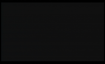 經(jīng)皮腎鏡手術(shù)治療及STORZ經(jīng)皮腎鏡 26092AMA維修案例分析